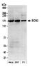 SOS Ras/Rho Guanine Nucleotide Exchange Factor 2 antibody, A301-893A, Bethyl Labs, Western Blot image 