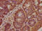 BRCA1 Associated ATM Activator 1 antibody, CSB-PA757659LA01HU, Cusabio, Immunohistochemistry paraffin image 