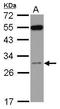 Ribosomal Protein S8 antibody, GTX120300, GeneTex, Western Blot image 