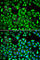 Proteasome 26S Subunit, ATPase 2 antibody, A1985, ABclonal Technology, Immunofluorescence image 
