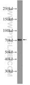 Ribosomal Oxygenase 1 antibody, 22842-1-AP, Proteintech Group, Western Blot image 