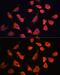 Prefoldin Subunit 5 antibody, GTX66432, GeneTex, Immunofluorescence image 