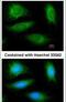 Ubiquitin carboxyl-terminal hydrolase CYLD antibody, PA5-29795, Invitrogen Antibodies, Immunofluorescence image 