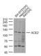 Angiotensin I Converting Enzyme 2 antibody, 10-602, ProSci, Western Blot image 