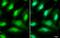 Unc-51 Like Autophagy Activating Kinase 2 antibody, NBP1-33136, Novus Biologicals, Immunocytochemistry image 