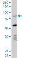Deleted in azoospermia protein 1 antibody, H00001617-M06, Novus Biologicals, Western Blot image 