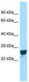 Coiled-Coil Domain Containing 90B antibody, TA338478, Origene, Western Blot image 