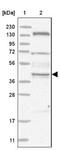 Endosome Associated Trafficking Regulator 1 antibody, NBP1-82507, Novus Biologicals, Western Blot image 