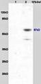 LYN Proto-Oncogene, Src Family Tyrosine Kinase antibody, orb6338, Biorbyt, Western Blot image 