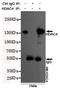 Histone Deacetylase 4 antibody, M00971-1, Boster Biological Technology, Immunoprecipitation image 
