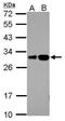 RILP-like protein 2 antibody, PA5-31792, Invitrogen Antibodies, Western Blot image 