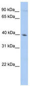 Outer Dense Fiber Of Sperm Tails 2 antibody, TA335815, Origene, Western Blot image 