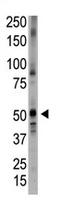 Bone morphogenetic protein 5 antibody, AP11666PU-N, Origene, Western Blot image 
