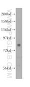 Prolyl endopeptidase antibody, 11536-1-AP, Proteintech Group, Western Blot image 