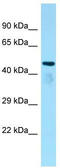 Alpha Tubulin Acetyltransferase 1 antibody, TA329481, Origene, Western Blot image 