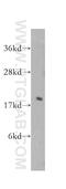 Eukaryotic translation initiation factor 5A-1 antibody, 11309-1-AP, Proteintech Group, Western Blot image 