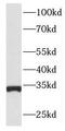 Inhibitor Of Growth Family Member 2 antibody, FNab04310, FineTest, Western Blot image 
