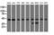 Carnosine N-Methyltransferase 1 antibody, GTX84742, GeneTex, Western Blot image 