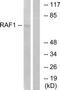 RAF proto-oncogene serine/threonine-protein kinase antibody, TA313052, Origene, Western Blot image 