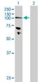 Hexokinase 3 antibody, H00003101-D01P, Novus Biologicals, Western Blot image 