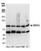 TFIIH basal transcription factor complex helicase XPB subunit antibody, A301-337A, Bethyl Labs, Western Blot image 