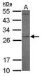Proteinase 3 antibody, PA5-30959, Invitrogen Antibodies, Western Blot image 