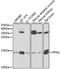 Profilin 2 antibody, 18-927, ProSci, Western Blot image 