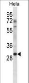 Non-Homologous End Joining Factor 1 antibody, LS-C164868, Lifespan Biosciences, Western Blot image 