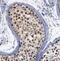 Sperm-associated antigen 5 antibody, FNab08143, FineTest, Immunohistochemistry frozen image 