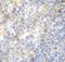 Zeta Chain Of T Cell Receptor Associated Protein Kinase 70 antibody, FNab09582, FineTest, Immunohistochemistry paraffin image 