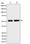 Hsp110 antibody, M30757, Boster Biological Technology, Western Blot image 