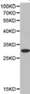 Natriuretic Peptide B antibody, TA321494, Origene, Western Blot image 