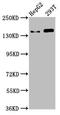 Structural Maintenance Of Chromosomes 5 antibody, LS-C671496, Lifespan Biosciences, Western Blot image 