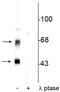 L-lysine N6-monooxygenase antibody, P30406, Boster Biological Technology, Western Blot image 