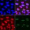 DNA polymerase delta catalytic subunit antibody, GTX64730, GeneTex, Immunofluorescence image 