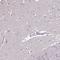 Coiled-Coil Domain Containing 85C antibody, NBP2-34194, Novus Biologicals, Immunohistochemistry frozen image 