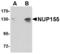 Nucleoporin 155 antibody, LS-C83892, Lifespan Biosciences, Western Blot image 