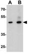 Zinc finger protein DPF3 antibody, GTX31560, GeneTex, Western Blot image 