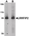 LRR Binding FLII Interacting Protein 2 antibody, PA5-21115, Invitrogen Antibodies, Western Blot image 