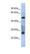 Testis Expressed 47 antibody, NBP1-70480, Novus Biologicals, Western Blot image 