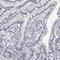 Carbonic anhydrase 6 antibody, HPA028550, Atlas Antibodies, Immunohistochemistry paraffin image 