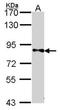 Dihydropyrimidine dehydrogenase [NADP+] antibody, orb69976, Biorbyt, Western Blot image 