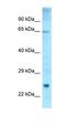 Electron transfer flavoprotein-ubiquinone oxidoreductase, mitochondrial antibody, orb331083, Biorbyt, Western Blot image 