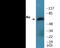 Interleukin 10 Receptor Subunit Alpha antibody, EKC2296, Boster Biological Technology, Western Blot image 