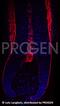 Keratin 17 antibody, GP-CK17, Progen Biotechnik GmbH, Immunofluorescence image 