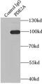 Phosphodiesterase 2A antibody, FNab06251, FineTest, Immunoprecipitation image 