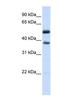 Leucine Rich Repeat Containing 24 antibody, NBP1-70621, Novus Biologicals, Western Blot image 