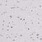 Zinc Finger Protein 860 antibody, NBP2-38026, Novus Biologicals, Immunohistochemistry paraffin image 