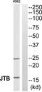 Jumping Translocation Breakpoint antibody, PA5-39364, Invitrogen Antibodies, Western Blot image 