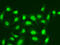 MID1 antibody, 19-647, ProSci, Immunofluorescence image 
